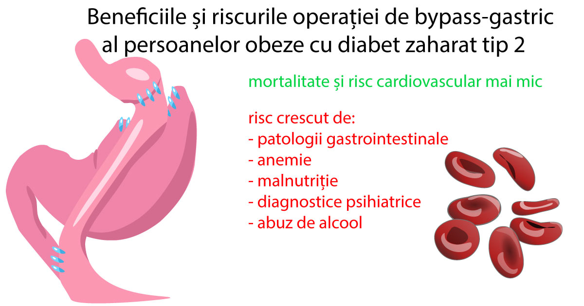 beneficii-riscuri-bypass-gastric