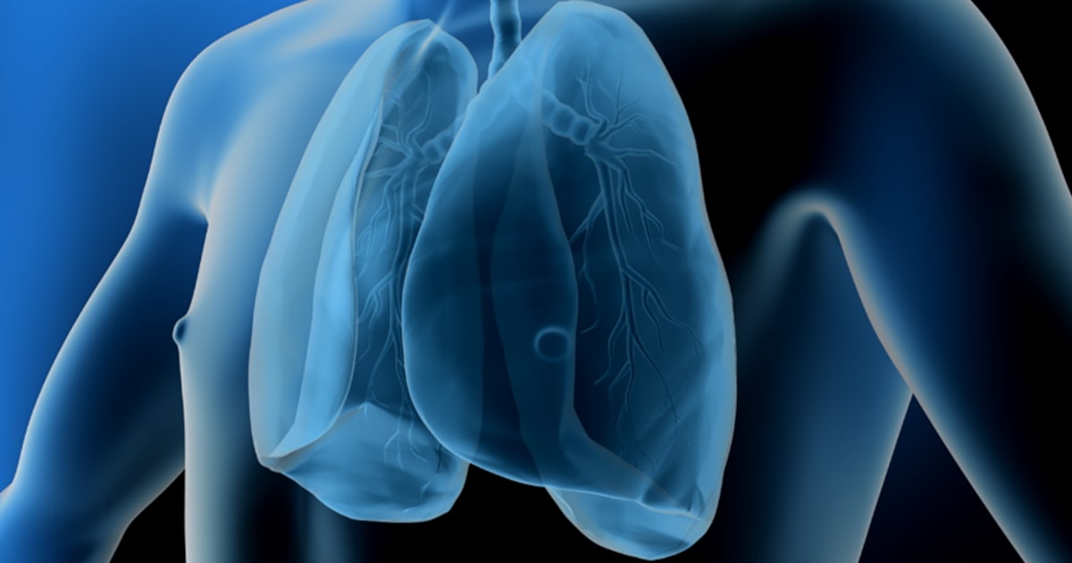 Supraviețuirea la 5 ani în cancerul pulmonar