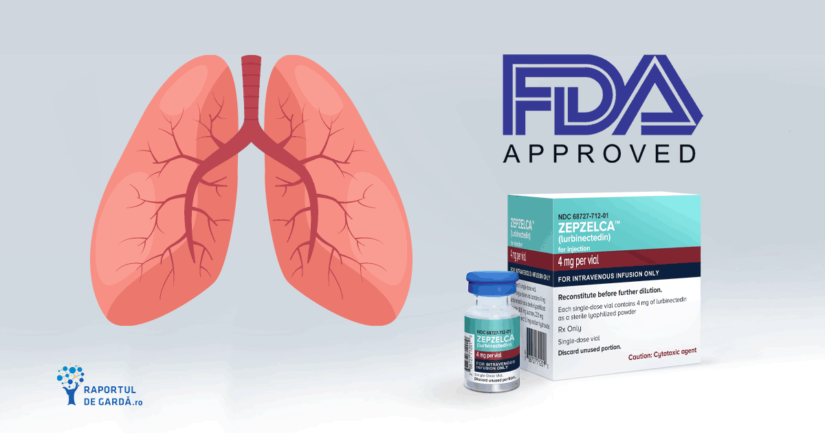 Lurbinectedin-primul medicament aprobat FDA din 1996 în tratamentul de a doua linie al cancerului pulmonar cu celule mici metastatic