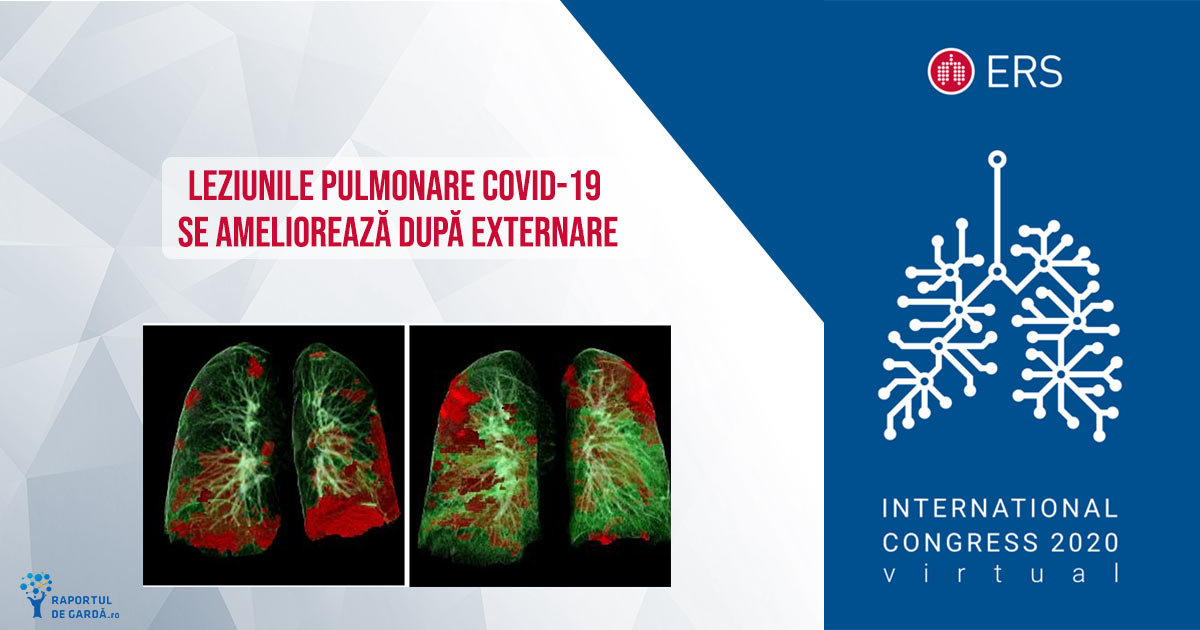 Imagine prezentare studiu evoluție leziuni pulmonare și cardiace COVID-19