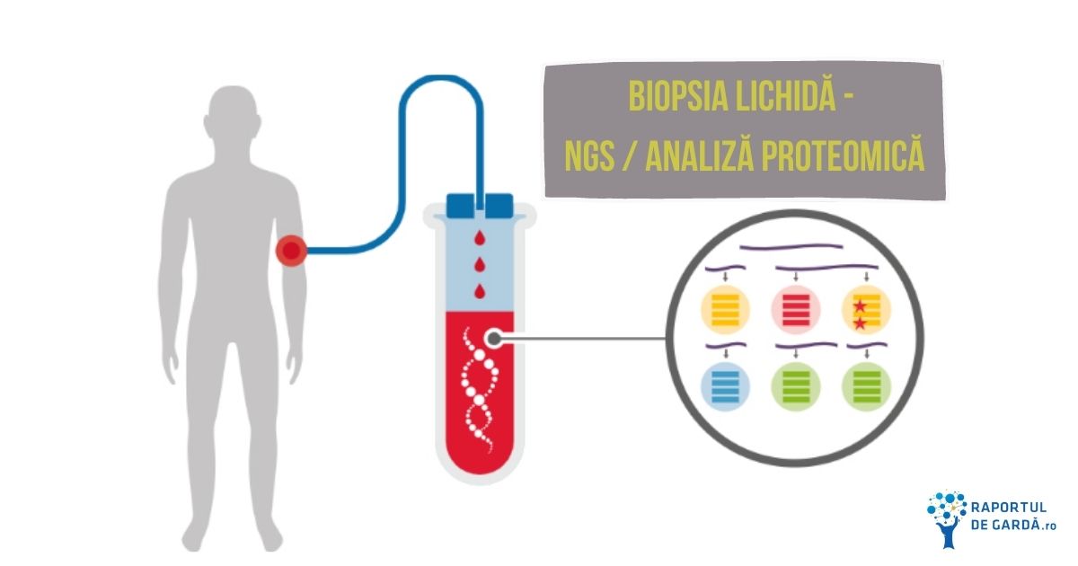 Biopsia lichida NGS analiza proteomică
