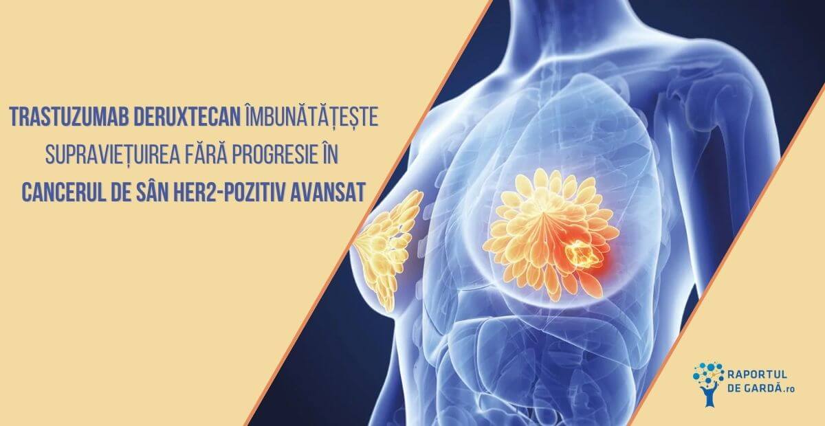 Trastuzumab deruxtecan supravietuire fara progresie cancer de san HER2-pozitiv avansat