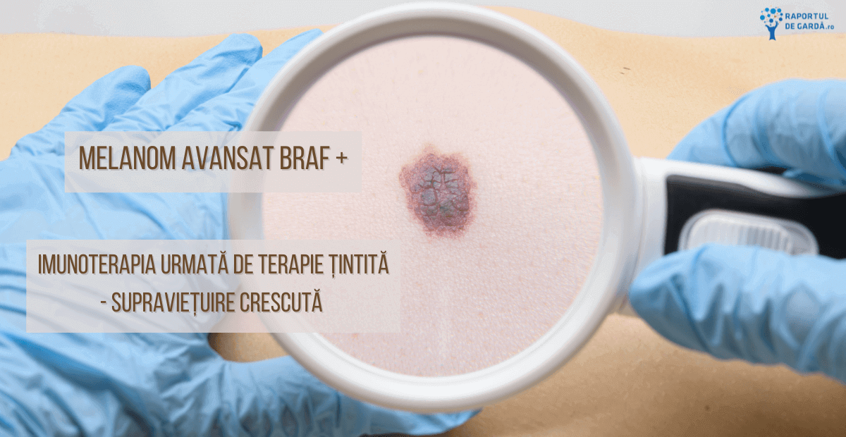 Imunoterapie terapie tintita melanom avansat BRAF pozitiv