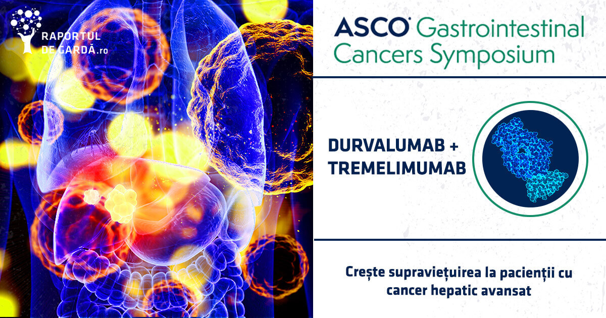 Combinația durvalumab + tremelimumab crește supraviețuirea la pacienții cu cancer hepatic avansat, comparativ cu sorafenib