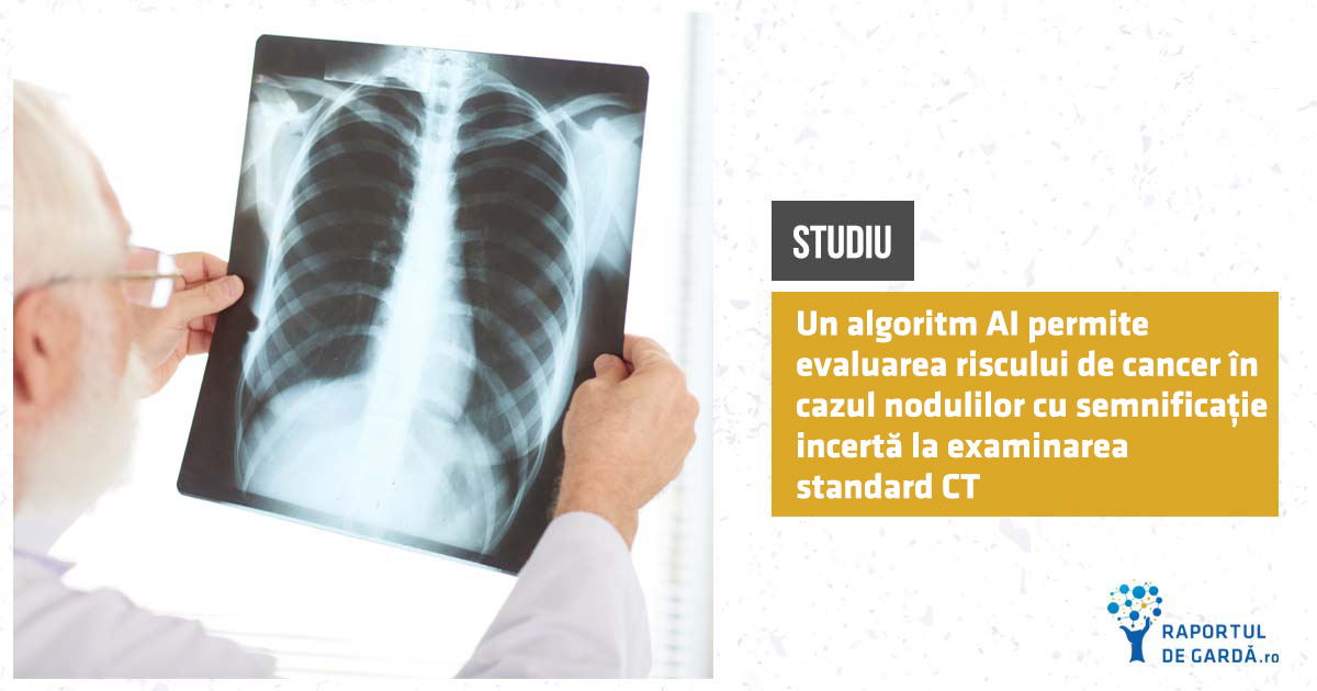 STUDIU. Evaluarea caracterului malign al nodulilor pulmonari identificați la examinarea CT poate fi optimizată folosind un algoritm bazat pe inteligență artificială