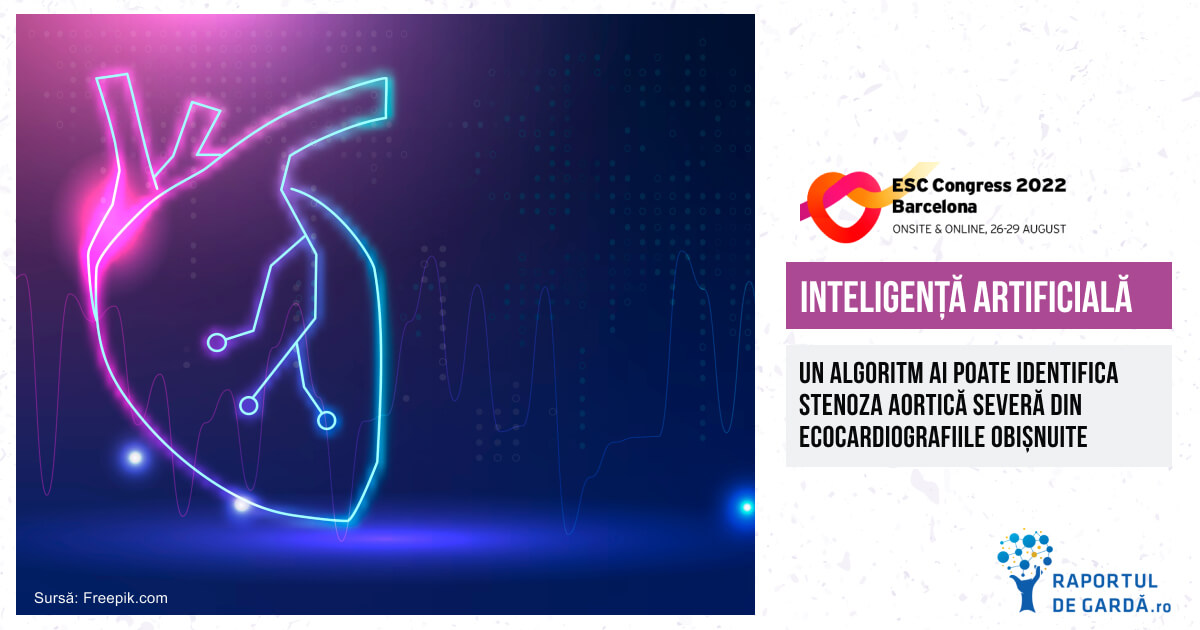 Un algoritm de inteligență artificială poate identifica stenoza aortică severă din ecocardiografiile obișnuite