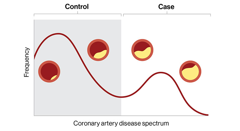 Boala coronariană abordată drept un spectru
