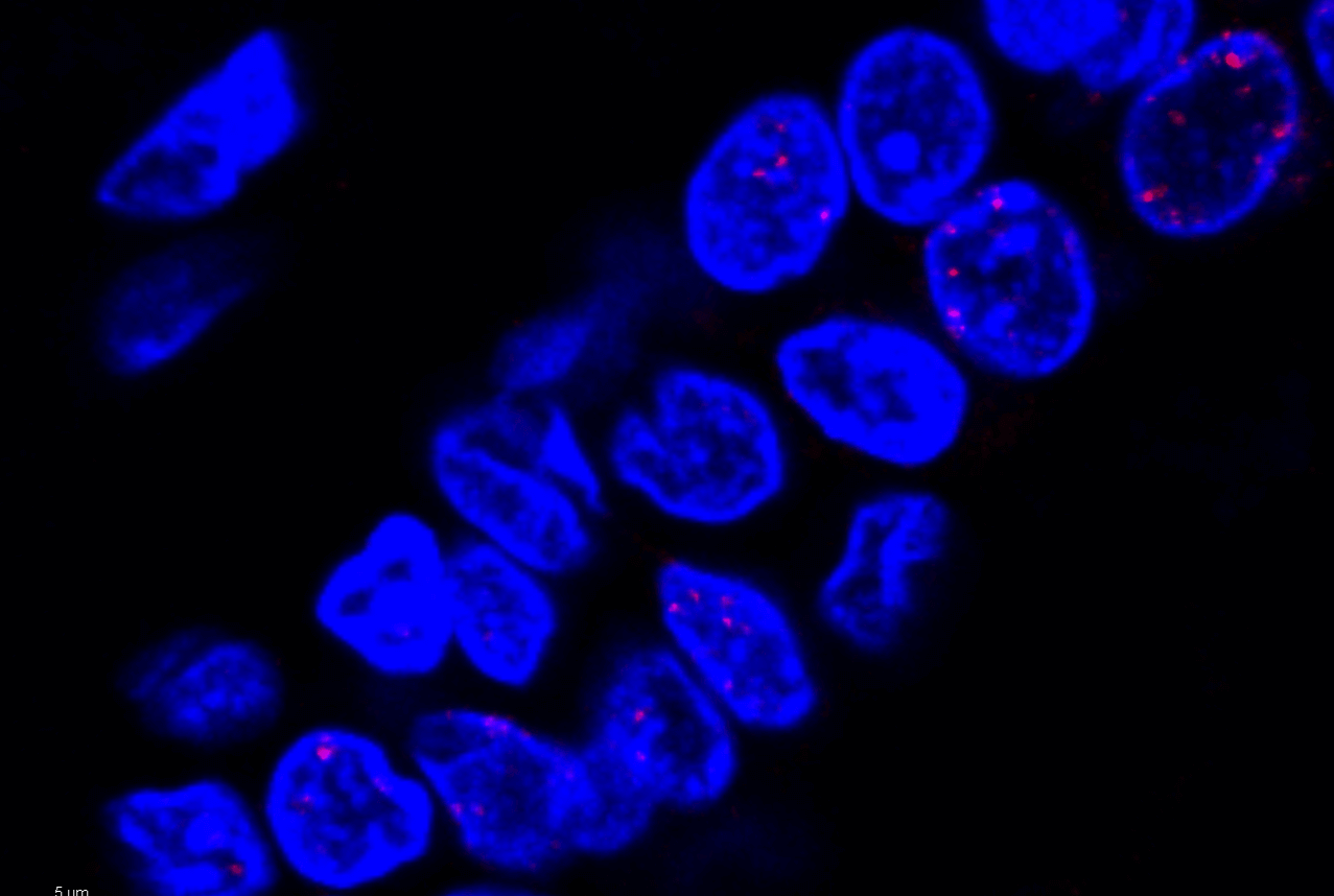 Celule din canalele galactofore