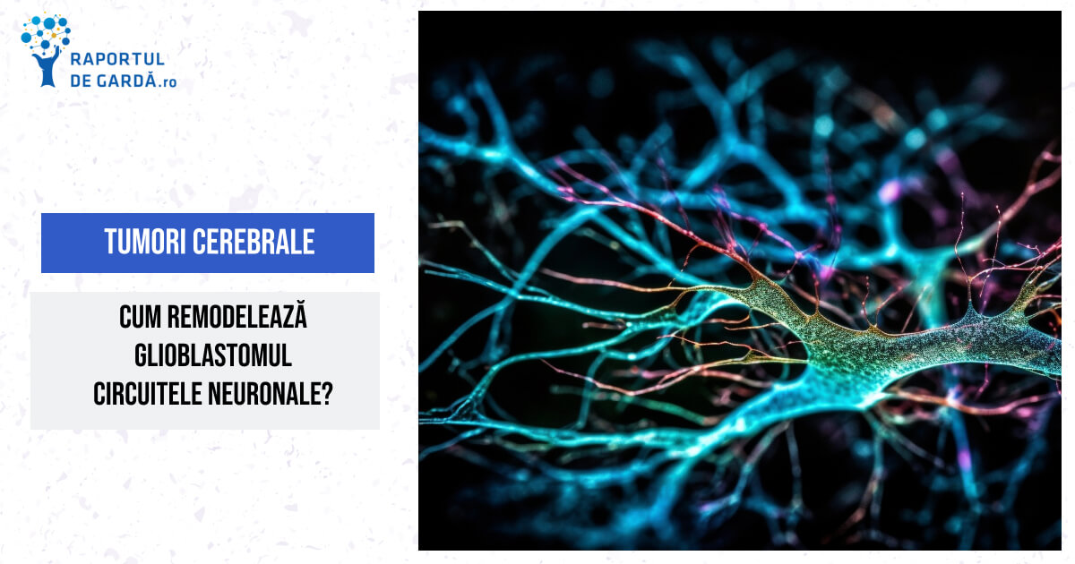 Glioblastomul și circuitele neuronale