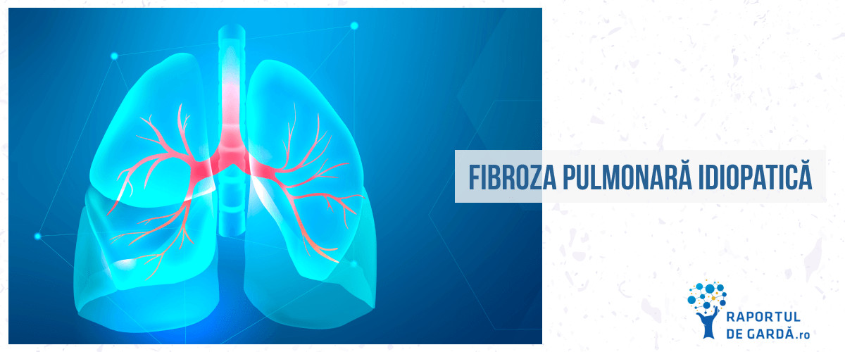 FAQ Fibroza pulmonară idiopatică
