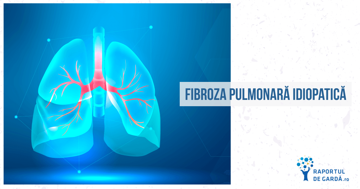 Întrebări frecvente despre fibroza pulmonară idiopatică
