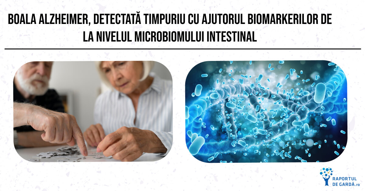 Boala Alzheimer și microbiota