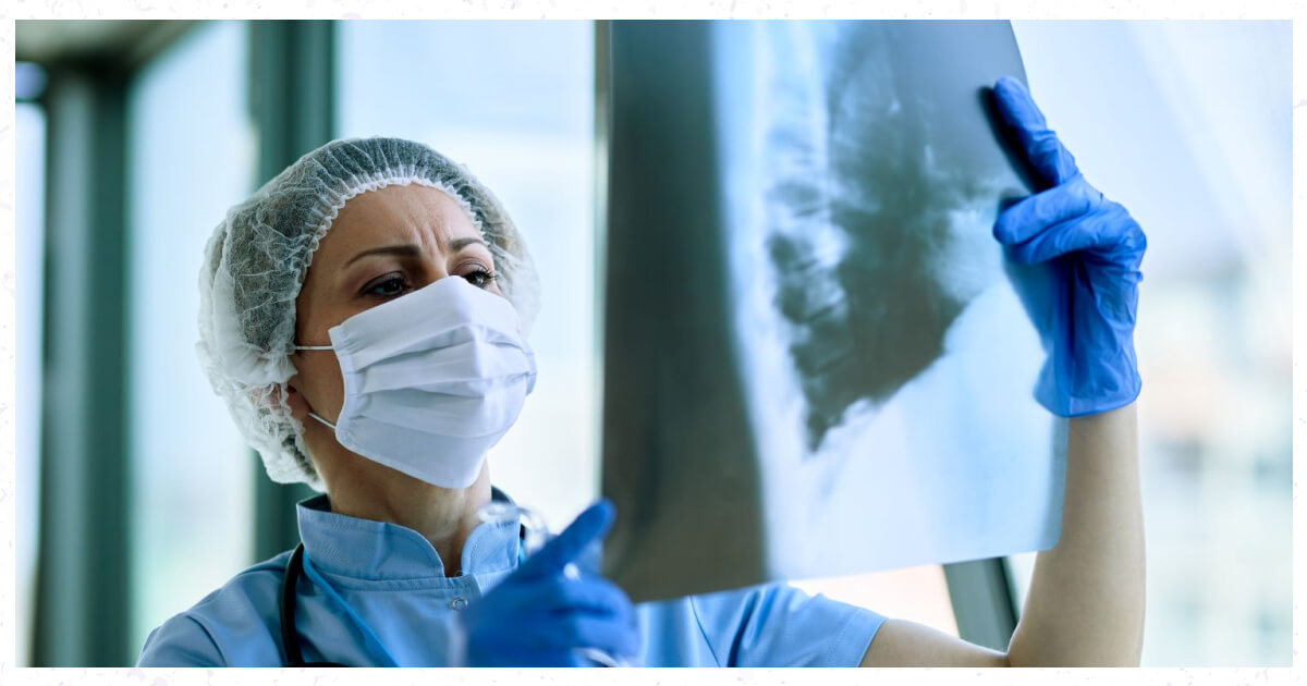 radiografie-torace-screening-cancer-pulmonar-stadiu-incipient