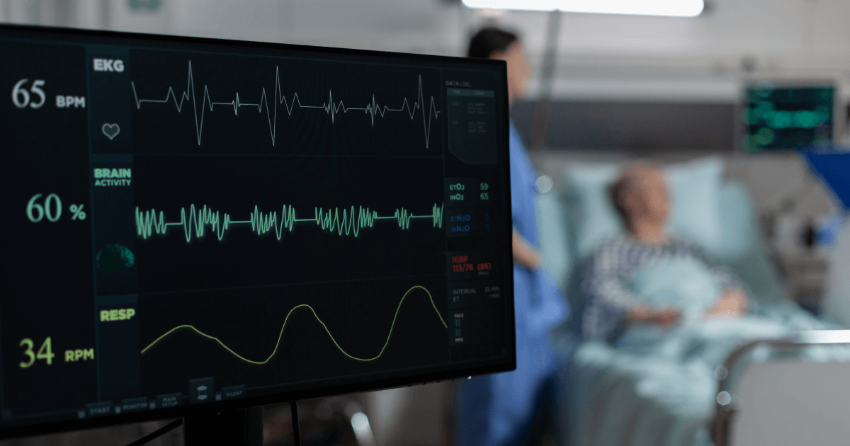 AI-EKG: alertarea pacienţilor cu risc ridicat de deces cu ajutorul inteligenţei artificiale reduce mortalitatea de toate cauzele
