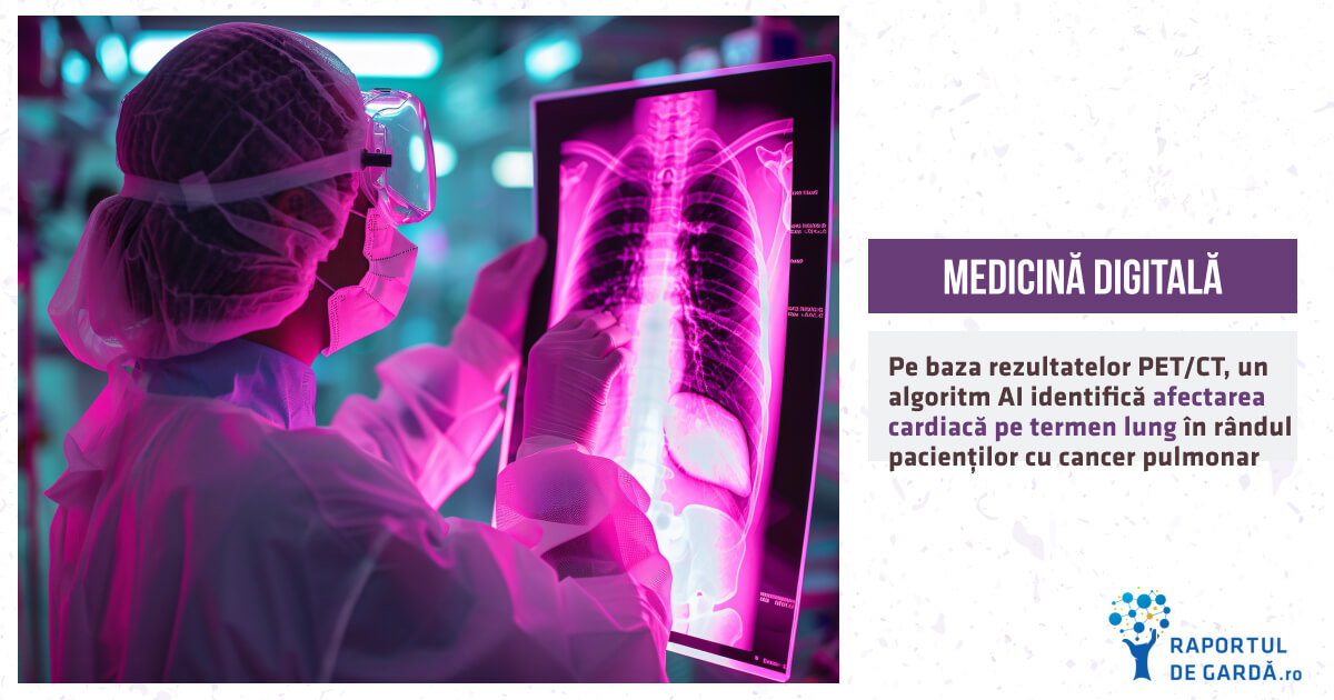 STUDIU. Pe baza rezultatelor PET/CT, un algoritm AI identifică afectarea cardiacă pe termen lung în rândul pacienților cu cancer pulmonar