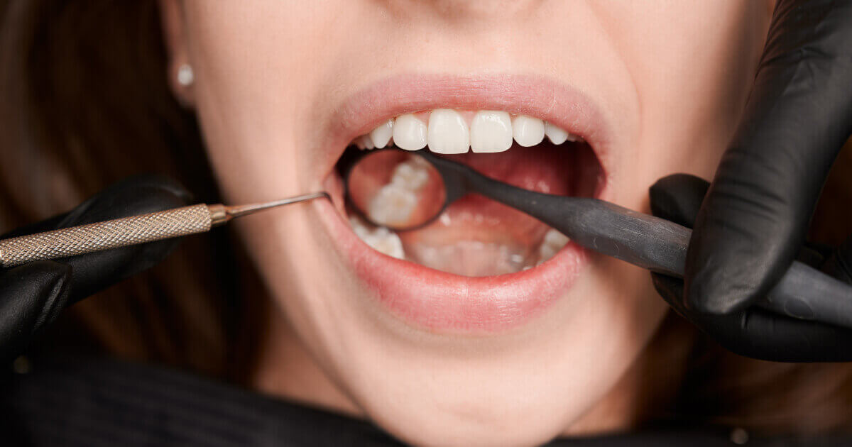 un pacient la dentist