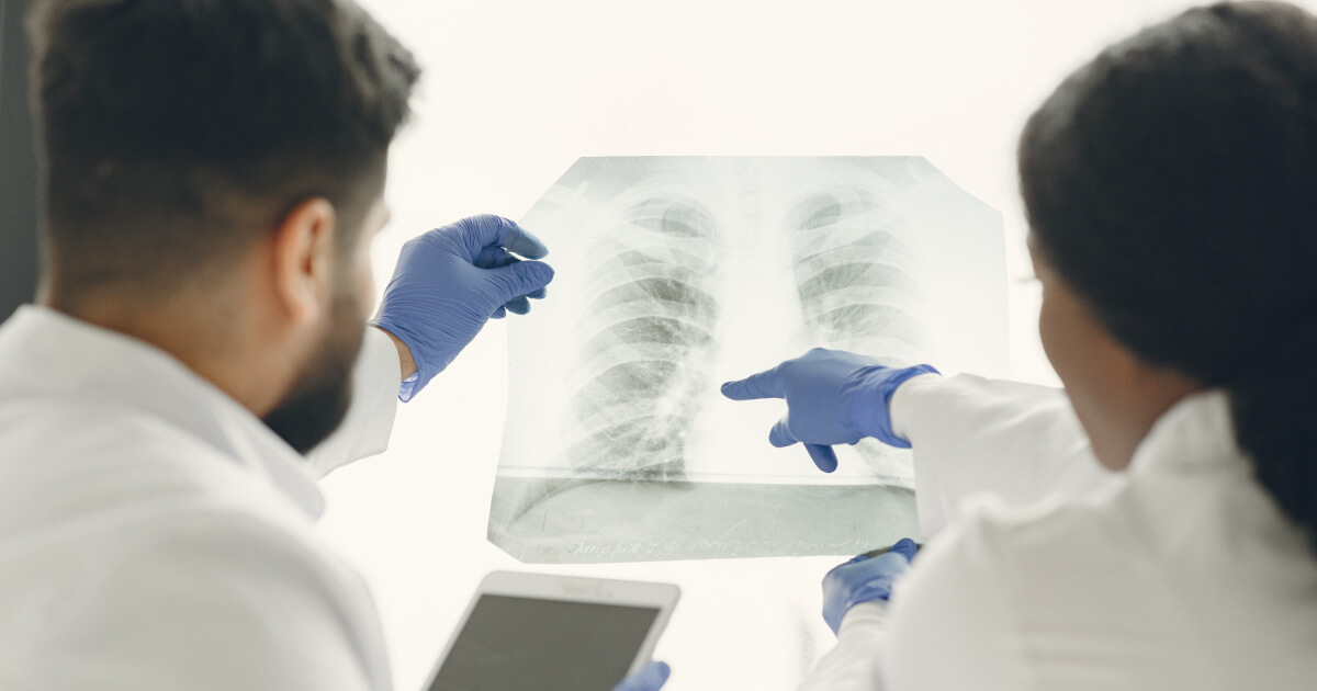 medici care analizeaza o radiografie a plamanilor
