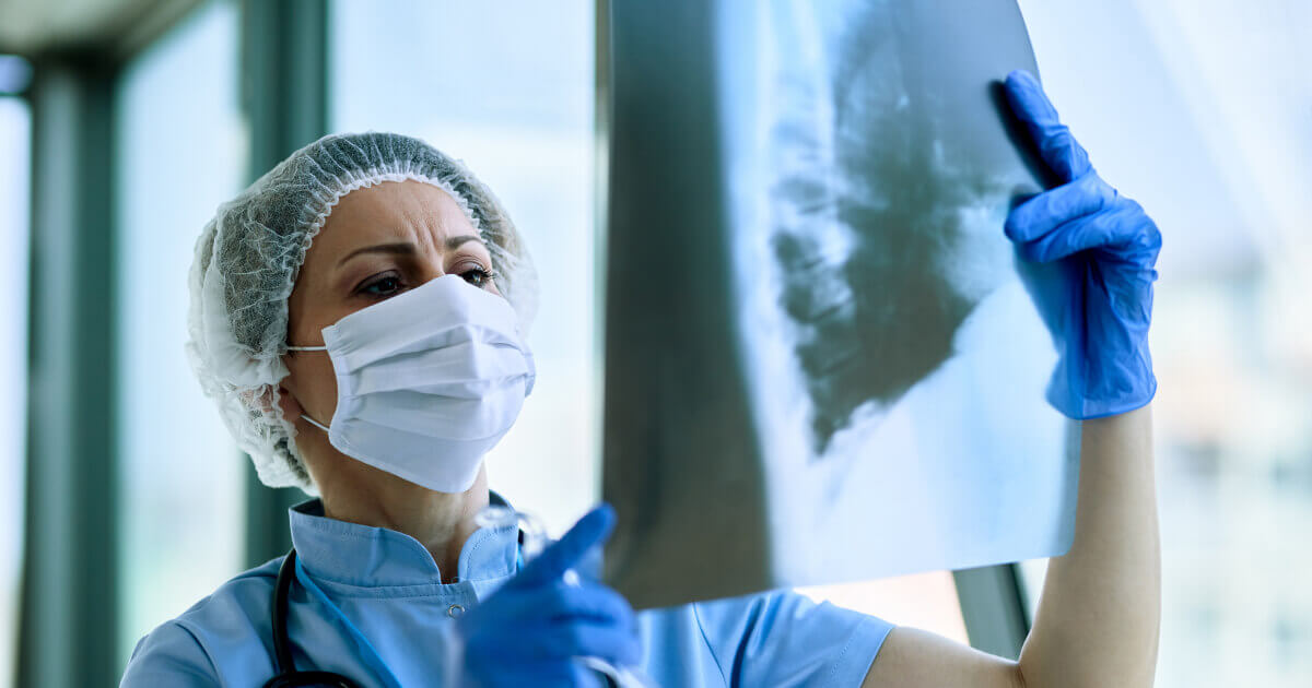radiologist care verifica o radiografie de plamani
