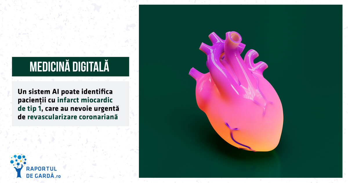 STUDIU. AI identifică pacienții cu infarct miocardic tip 1, care au nevoie urgentă de revascularizare coronariană, pe baza electrocardiogramei