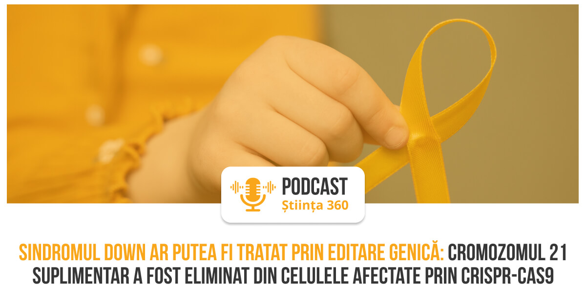 Sindrom Down tratat prin editare genică CRISPR-Cas9