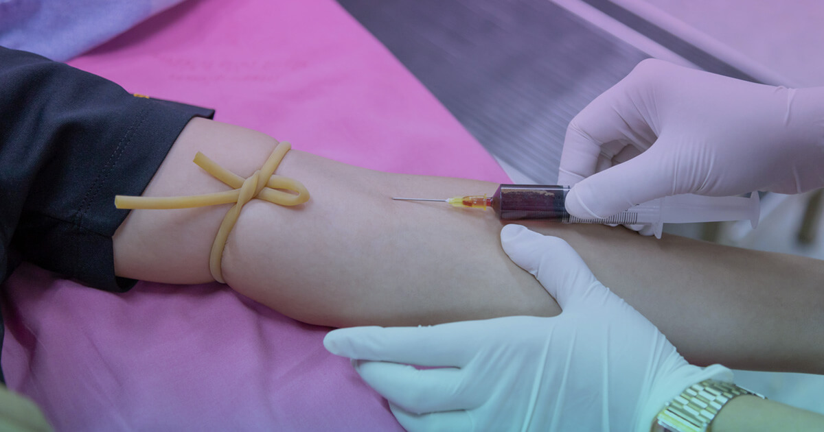 testare biopsie lichida