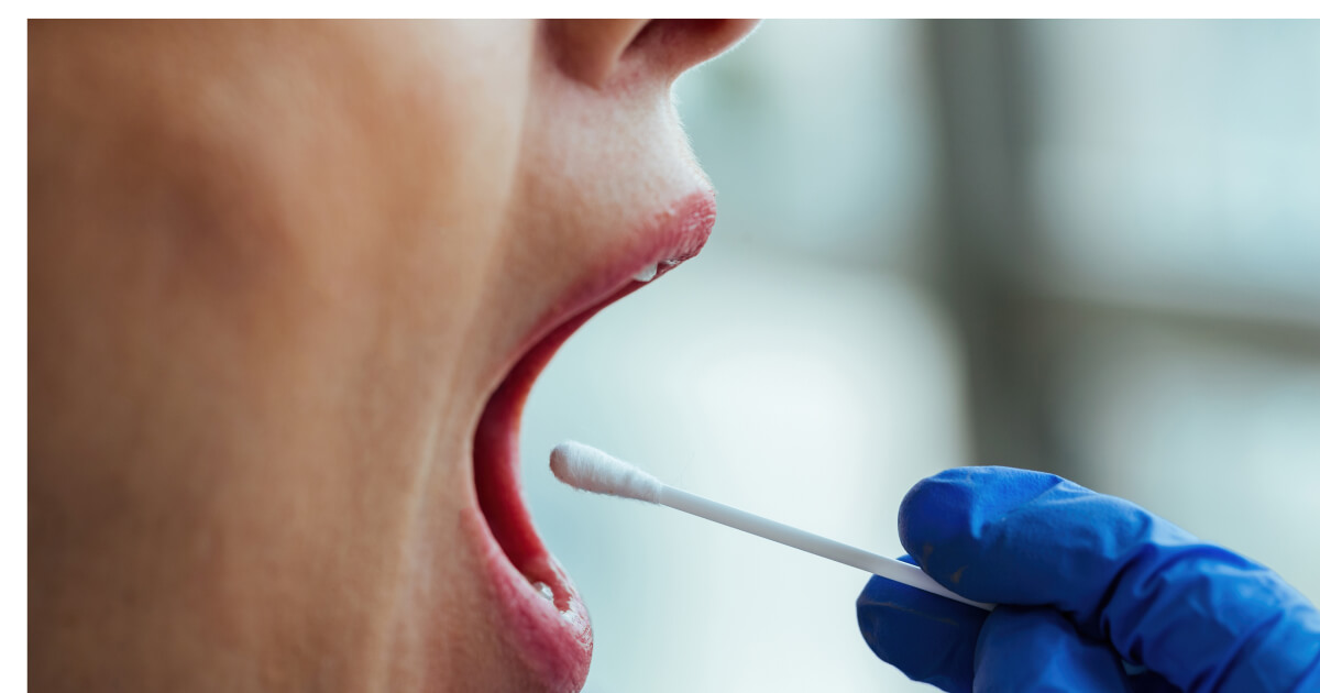 pacient care este testat folosind un betisor bucal